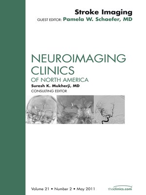 cover image of Imaging of Ischemic Stroke, an Issue of Neuroimaging Clinics